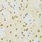 SUZ12 Polycomb Repressive Complex 2 Subunit antibody, GTX64485, GeneTex, Immunohistochemistry paraffin image 