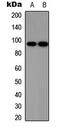 SRY-Box 6 antibody, LS-C358331, Lifespan Biosciences, Western Blot image 