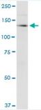 Codanin 1 antibody, H00146059-M01-100ug, Novus Biologicals, Western Blot image 