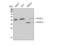 DNA Fragmentation Factor Subunit Alpha antibody, STJ93633, St John