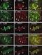 Transient Receptor Potential Cation Channel Subfamily V Member 1 antibody, PA1-29770, Invitrogen Antibodies, Immunofluorescence image 