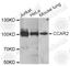 Cell Cycle And Apoptosis Regulator 2 antibody, A7126, ABclonal Technology, Western Blot image 