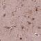 Sorcin antibody, PA5-67302, Invitrogen Antibodies, Immunohistochemistry frozen image 