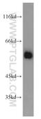 Formimidoyltransferase Cyclodeaminase antibody, 21959-1-AP, Proteintech Group, Western Blot image 