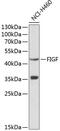 Vascular Endothelial Growth Factor D antibody, GTX32963, GeneTex, Western Blot image 