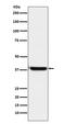 8-Oxoguanine DNA Glycosylase antibody, M00768-1, Boster Biological Technology, Western Blot image 