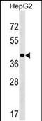 Protein Arginine Methyltransferase 9 antibody, PA5-48954, Invitrogen Antibodies, Western Blot image 