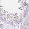 Myozenin 1 antibody, PA5-58387, Invitrogen Antibodies, Immunohistochemistry frozen image 