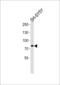 Origin Recognition Complex Subunit 3 antibody, LS-C163270, Lifespan Biosciences, Western Blot image 