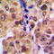RAD52 Motif Containing 1 antibody, LS-C358275, Lifespan Biosciences, Immunohistochemistry paraffin image 