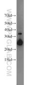 Charged Multivesicular Body Protein 1A antibody, 15761-1-AP, Proteintech Group, Western Blot image 