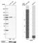 DM1 Protein Kinase antibody, NBP1-85010, Novus Biologicals, Western Blot image 