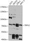 Transient Receptor Potential Cation Channel Subfamily V Member 2 antibody, 14-380, ProSci, Western Blot image 