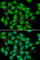 Antioxidant 1 Copper Chaperone antibody, A6874, ABclonal Technology, Immunofluorescence image 