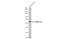 Calcium/Calmodulin Dependent Protein Kinase II Beta antibody, GTX133072, GeneTex, Western Blot image 