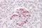 Suppressor Of Cytokine Signaling 4 antibody, orb18412, Biorbyt, Immunohistochemistry paraffin image 