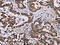 Dual Specificity Phosphatase 4 antibody, CSB-PA126732, Cusabio, Immunohistochemistry paraffin image 