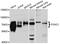 Forkhead Box C1 antibody, abx007281, Abbexa, Western Blot image 