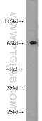 Tyrosyl-DNA Phosphodiesterase 1 antibody, 10641-1-AP, Proteintech Group, Western Blot image 