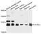 Calcium Voltage-Gated Channel Auxiliary Subunit Gamma 1 antibody, A10014, ABclonal Technology, Western Blot image 