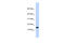 TPD52 Like 3 antibody, 31-333, ProSci, Enzyme Linked Immunosorbent Assay image 