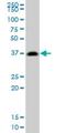 Protein Activator Of Interferon Induced Protein Kinase EIF2AK2 antibody, H00008575-M02, Novus Biologicals, Western Blot image 