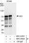 Hematopoietic Cell-Specific Lyn Substrate 1 antibody, NBP2-04028, Novus Biologicals, Immunoprecipitation image 