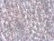 Insulin Receptor Substrate 1 antibody, GTX133848, GeneTex, Immunohistochemistry paraffin image 