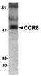 C-C chemokine receptor type 8 antibody, orb74363, Biorbyt, Western Blot image 