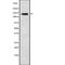 Phosphorylase Kinase Regulatory Subunit Alpha 1 antibody, abx217736, Abbexa, Western Blot image 