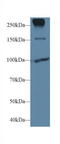 Cadherin 1 antibody, LS-C301376, Lifespan Biosciences, Western Blot image 