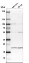Transmembrane Protein 109 antibody, NBP1-93462, Novus Biologicals, Western Blot image 