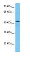 Interferon kappa antibody, orb326427, Biorbyt, Western Blot image 