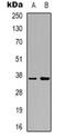 Aldo-Keto Reductase Family 1 Member C2 antibody, orb318803, Biorbyt, Western Blot image 