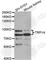 Transient Receptor Potential Cation Channel Subfamily V Member 4 antibody, A5660, ABclonal Technology, Western Blot image 