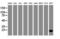 Cellular Retinoic Acid Binding Protein 2 antibody, LS-C175117, Lifespan Biosciences, Western Blot image 