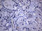 DNA Polymerase Iota antibody, M01376, Boster Biological Technology, Immunohistochemistry paraffin image 