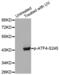 ATF4 antibody, abx000357, Abbexa, Western Blot image 