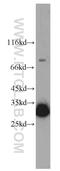 Synaptonemal Complex Protein 3 antibody, 23024-1-AP, Proteintech Group, Western Blot image 