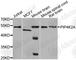 Phosphatidylinositol-5-Phosphate 4-Kinase Type 2 Alpha antibody, A7446, ABclonal Technology, Western Blot image 