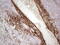 Colony Stimulating Factor 1 antibody, M00620-1, Boster Biological Technology, Immunohistochemistry paraffin image 