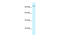 SWI/SNF Related, Matrix Associated, Actin Dependent Regulator Of Chromatin Subfamily C Member 1 antibody, 27-825, ProSci, Western Blot image 