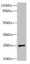 Phosphatidylinositol Glycan Anchor Biosynthesis Class H antibody, orb29269, Biorbyt, Western Blot image 