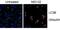 Microtubule Associated Protein 1 Light Chain 3 Beta antibody, PA1-46286, Invitrogen Antibodies, Immunofluorescence image 