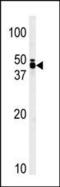 Tribbles homolog 1 antibody, PA5-14801, Invitrogen Antibodies, Western Blot image 