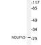 NADH:Ubiquinone Oxidoreductase Core Subunit V2 antibody, LS-C177385, Lifespan Biosciences, Western Blot image 