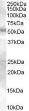 MADH9 antibody, GTX89360, GeneTex, Western Blot image 