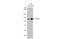 CYLD Lysine 63 Deubiquitinase antibody, GTX636662, GeneTex, Western Blot image 