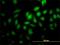 Protein Geranylgeranyltransferase Type I Subunit Beta antibody, H00005229-M02, Novus Biologicals, Immunofluorescence image 