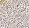 H1 Histone Family Member 0 antibody, M08821-2, Boster Biological Technology, Immunohistochemistry paraffin image 